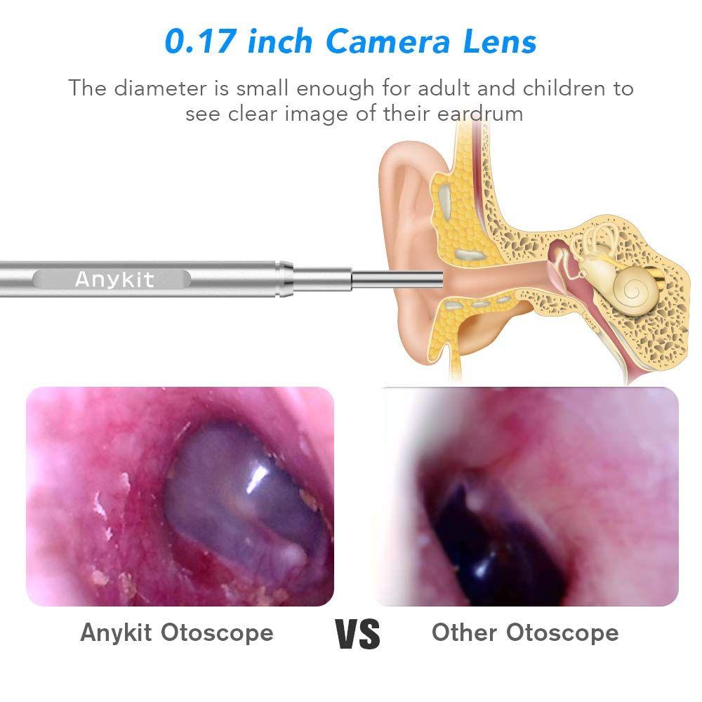 Otoscope caméra pour oreille thumbnail