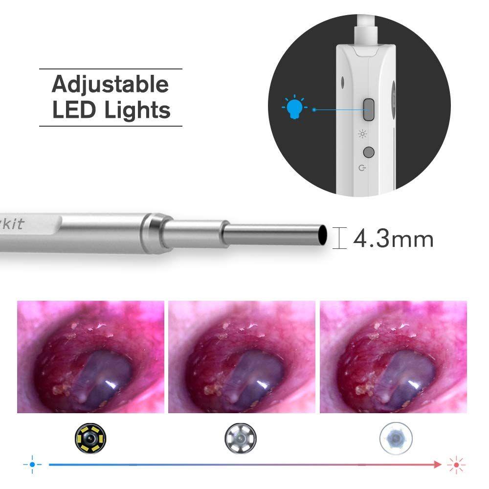 Otoscope caméra pour oreille thumbnail