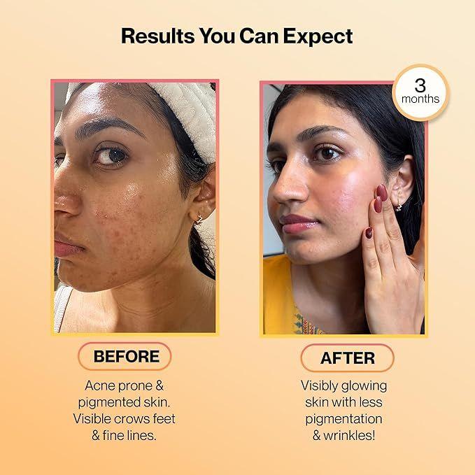 SETU Skin Renew Glutathione Fizz & Poudre de Collagène  thumbnail